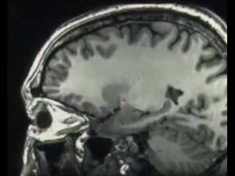 Free the Mind - bande annonce - VO - (2012)