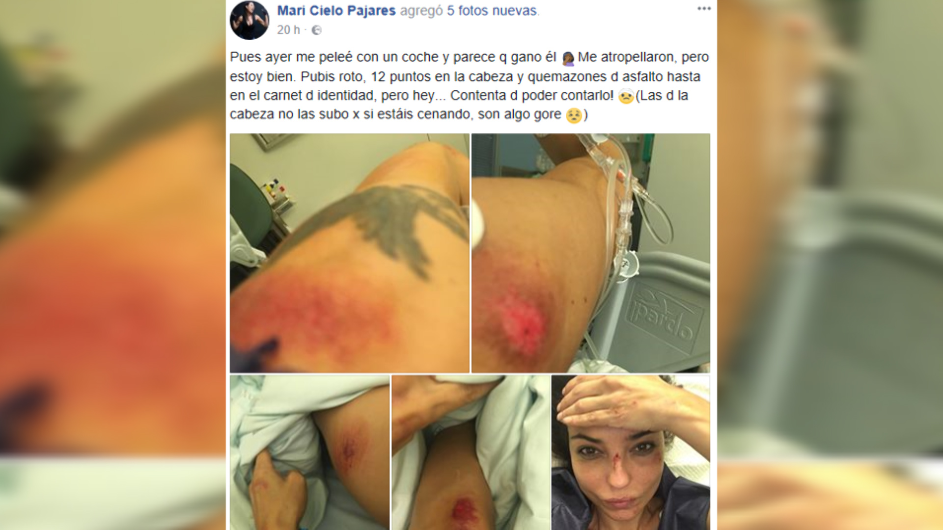 VIDEO : Mari Cielo Pajares sale del hospital tras un grave accidente