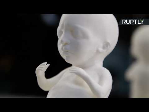 Expecting Mothers Can Now Print 3D Models of Their Unborn Child