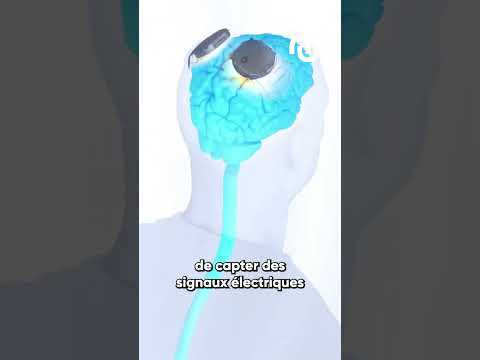 Un implant qui permet aux personnes handicapées de marcher à nouveau ? #shorts