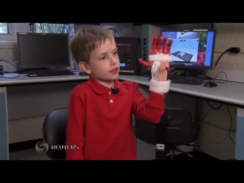 North Carolina boy gets prosthetic hand made from a 3-D printer