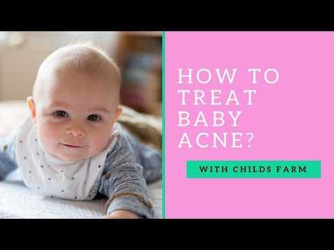 What is Baby Acne and how do you treat it? With Dr Jennifer Crawley and Childs Farm! #ad
