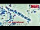 On vous explique ce qu'est la teigne en 35 secondes - Label : Le Républicain Lorrain - Category : News