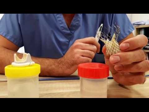 Hôpital Claude Bernard : Bâtiment féminéa cardiologie