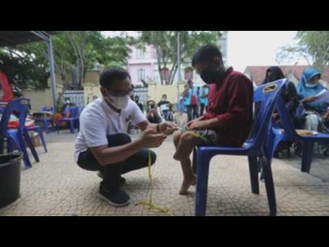 Indonesia donates prosthetic legs for people in need
