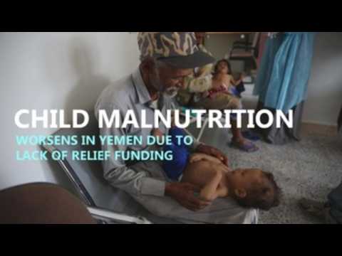 Child malnutrition worsens in Yemen due to lack of relief funding