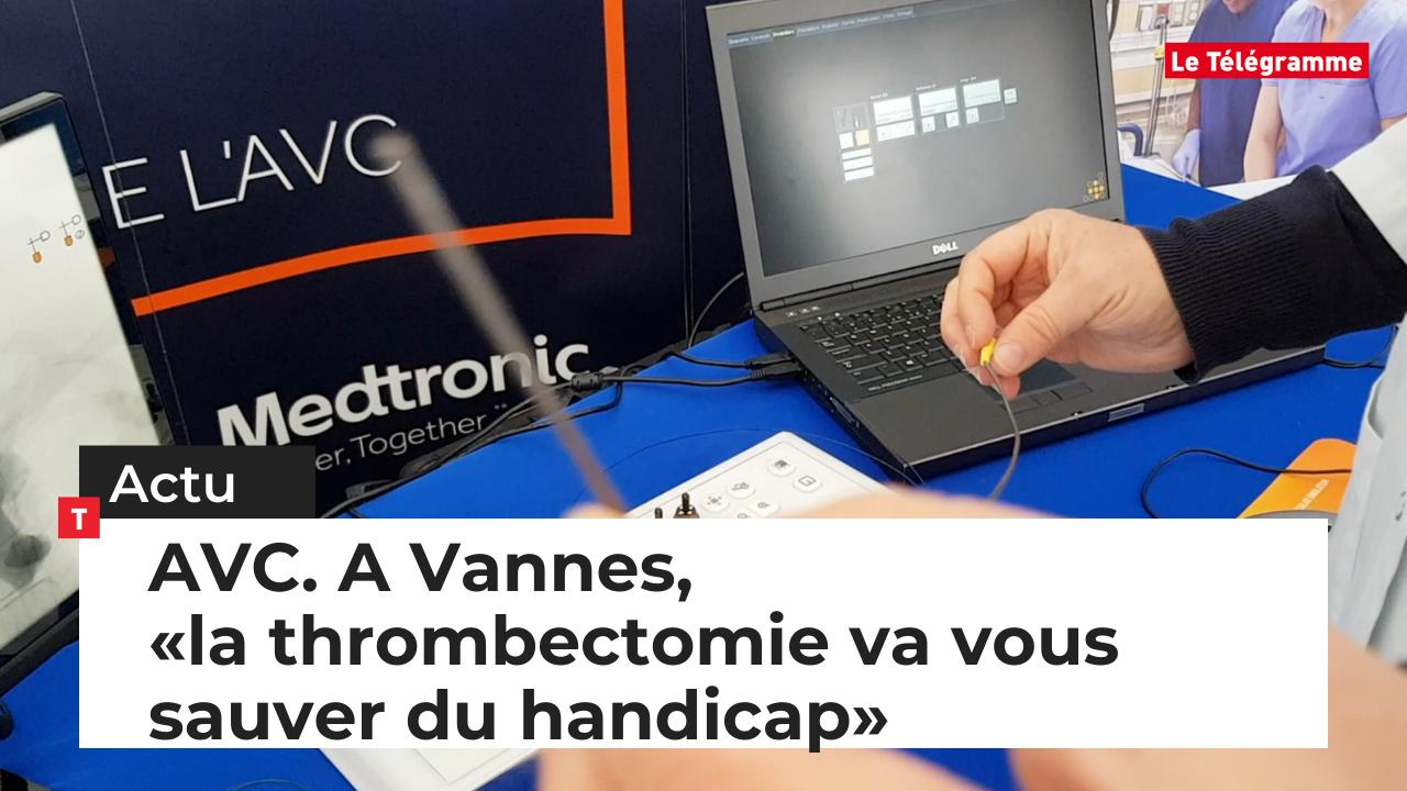 AVC. A Vannes, «la thrombectomie va vous sauver du handicap» (Le Télégramme)