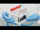 COVID-19 antibody tests on Moscow citizens
