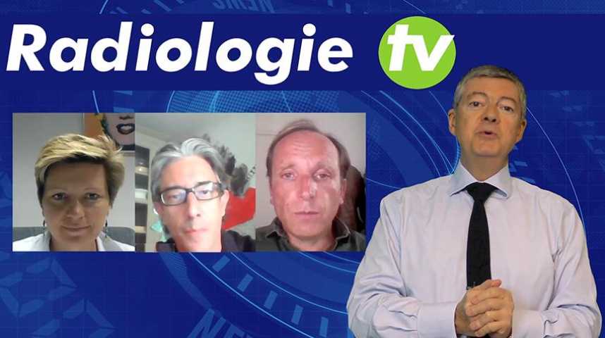 JT de la radiologie-7- La radiologie interventionnelle 