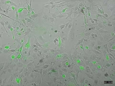 Le virus inactivé du vaccin ROR tue des cellules cancéreuses