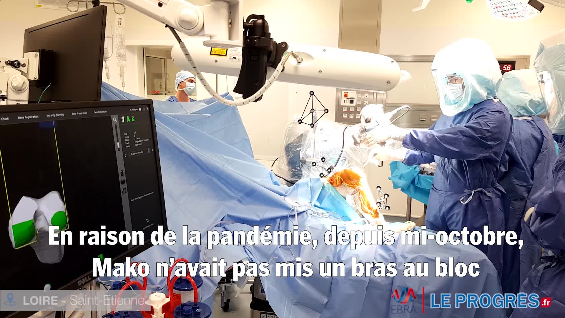 Loire. Robot Mako en chirurgie orthopédique : « Tous les bénéfices avancés  par les études se vérifient »