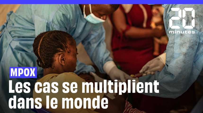 Mpox : Quels sont les symptômes de la nouvelle souche qui inquiète l'OMS ?