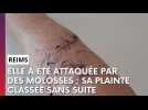 Elle avait été attaquée par deux molosses à Reims : sa plainte a été classée sans suite