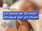 Un bébé de 20 mois attaqué par un chien