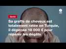 VIDEO. Sa greffe de cheveux est totalement ratée en Turquie, il dépense 18 000 ¬ pour réparer les dégâts