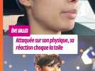 Eve Gilles (Miss France 2024) attaquée sur son apparence : sa réaction choque la toile