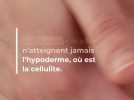 Consommation - Ventouses, crèmes, massages... Pourquoi les traitements 