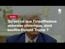 VIDEO. Qu'est-ce que l'insuffisance veineuse chronique, dont souffre Donald Trump ?