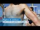 Méduses :que faire en cas de piqûre ?