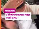 Nikola Lozina affiche son nouveau visage et fait le buzz
