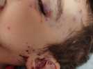 Un enfant de 2 ans violemment attaqué dans son sommeil par un rongeur dans un logement social!