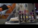 Brest : Un appel aux dons de plasma