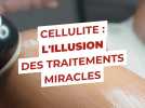 Pourquoi les traitements "miracles" contre la cellulite sont en réalité une vaste arnaque ?