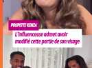 Poupette Kenza de retour sur les réseaux, elle admet avoir modifié cette partie de son visage