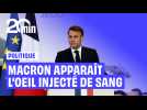 Emmanuel Macron apparaît l'oeil droit rougi et enflé lors des vSux aux Armées et ironise