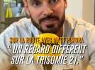 Sur la route avec Matt Pokora : L'objectif de cette aventure est de changer les regards sur la Trisomie 21