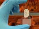 Une oreille humaine fonctionnelle imprimée en 3D à partir de cartilages humains