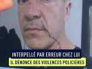 "Il m'a cassé l'arrête nasale" : Interpellé par erreur à son domicile, ce Niçois dénonce des violences policières