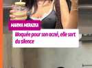 « Ne me jugez pas » : Marwa Merazka moquée pour son acné, elle sort du silence