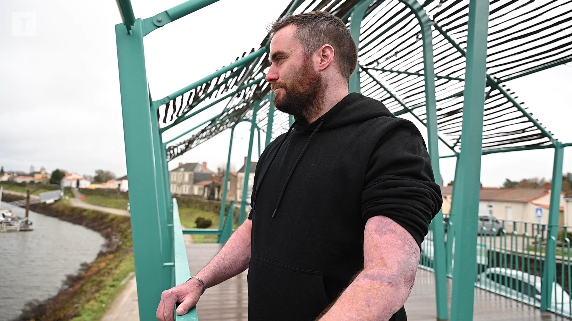 « Je suis un miraculé et je veux donner de l'espoir aux blessés de Crans-Montana » : brûlé sur 85 % du corps en juillet 2023, le Nantais Thomas Janin raconte deux ans et demi de résilience [Vidéo]