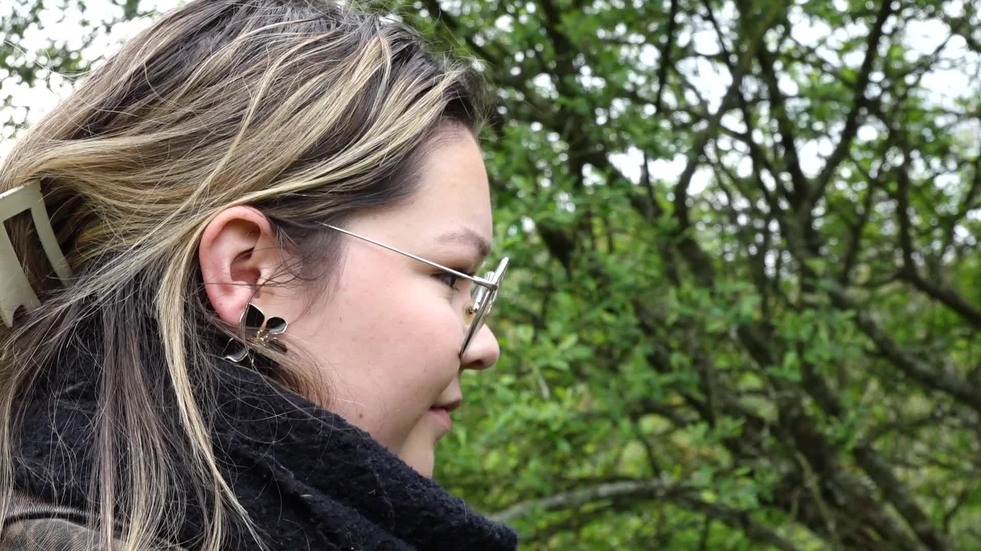 « Il s’est acharné sur moi » : chargée par un sanglier près de Morlaix, cette promeneuse veut alerter [Vidéo]