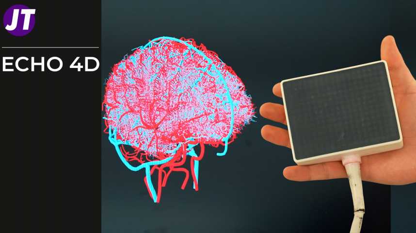 ECHO 4D